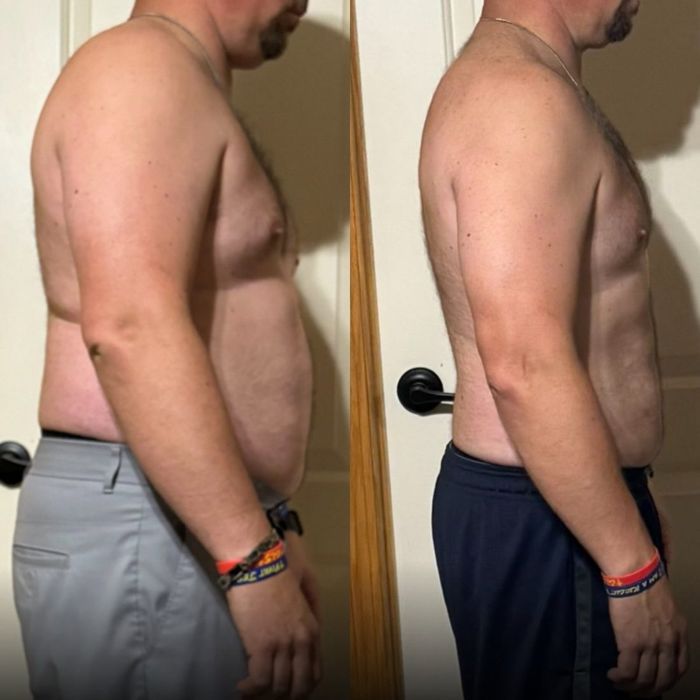 FORTUS member before and after